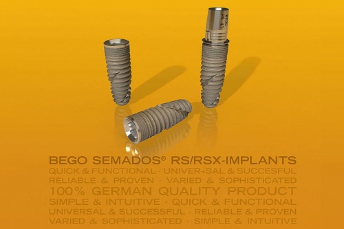 BEGO Semados® RS/RSX Implants – The right product for many indications in implant dentistry